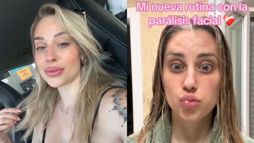 Ex chica reality Gemma Collado muestra su rutina tras sufrir parálisis facial