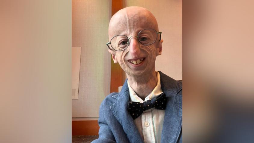 Muere Sammy Basso, la persona con progeria más longeva del mundo