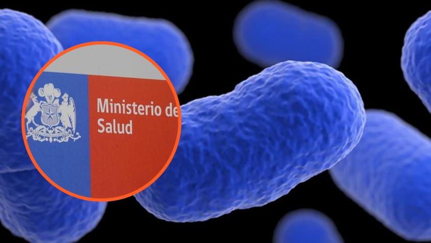 Minsal informa “alerta alimentaria” por presencia de Listeria en 4 alimentos comercializados en Chile