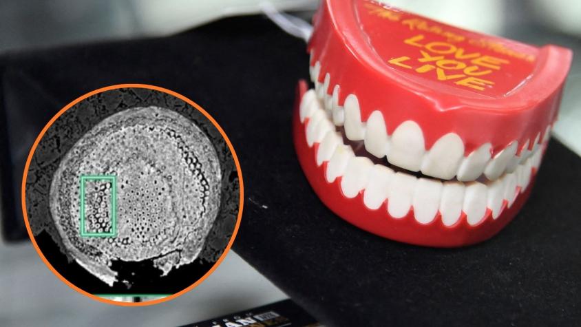¿Le duelen los dientes? Podría deberse a un pez de hace 500 millones de años ¿Le duelen los dientes? Podría deberse a un pez de hace 500 millones de años