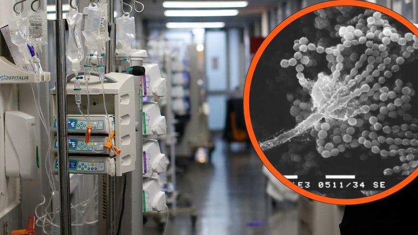 Contagios con hongo Aspergillus en Hospital El Pino: Minsal sospecha de "infección intrahospitalaria"