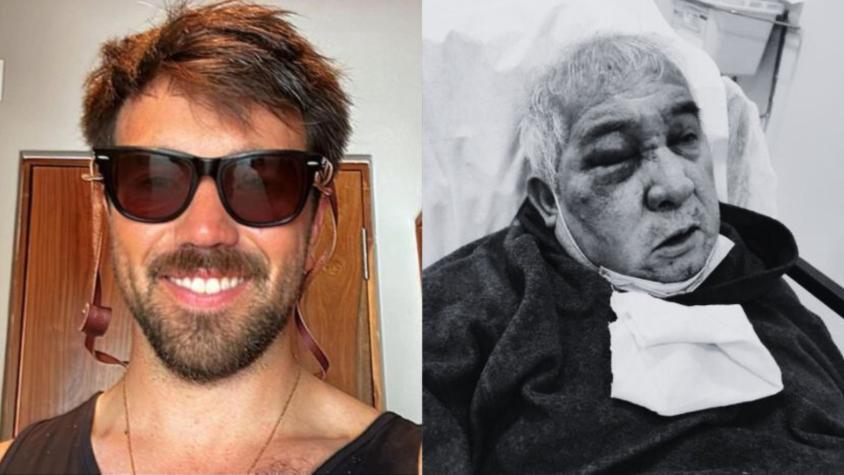 "El ojo, al parecer, se perdió al 100 por 100": Conserje agredido por empresario en Vitacura sufre terrible diagnóstico