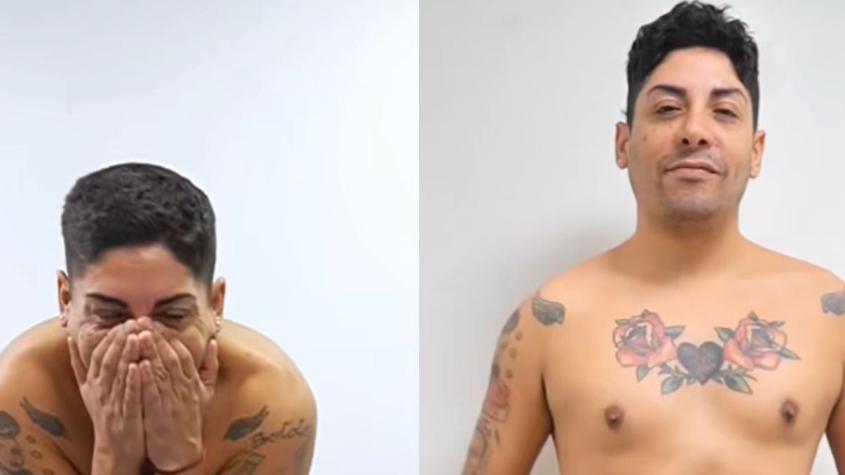 Botota Fox impacta al presumir resultados a dos meses de su cirugía estética: mostró el antes y el ahora Botota Fox impacta al presumir resultados a dos meses de su cirugía estética: mostró el antes y el ahora