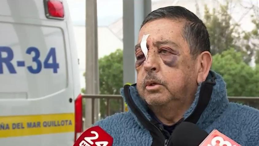 Conductor de bus fue brutalmente agredido y casi pierde la visión de un ojo: uno de los atacantes quedó en prisión preventiva Conductor de bus fue brutalmente agredido y casi pierde la visión de un ojo: uno de los atacantes quedó en prisión preventiva