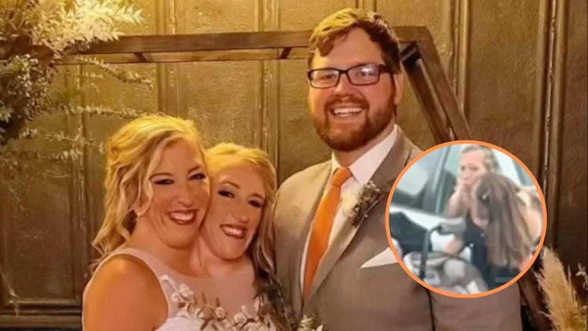 Siamesas Abby y Brittany Hensel levantan rumores de maternidad tras fotografías con bebé Siamesas Abby y Brittany Hensel levantan rumores de maternidad tras fotografías con bebé