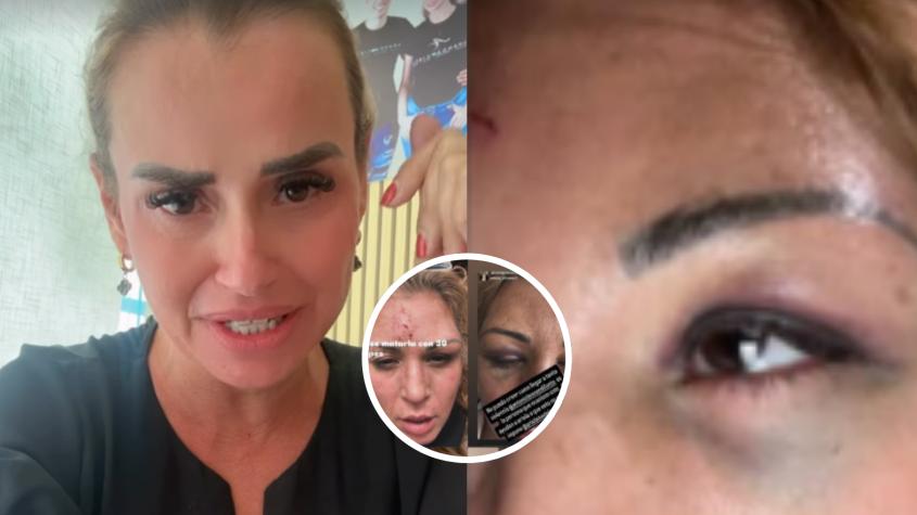 Exbailarina de Axé Bahía, Amanda Cibely, denuncia terrible agresión a exchica Mekano: “Es una brutalidad”