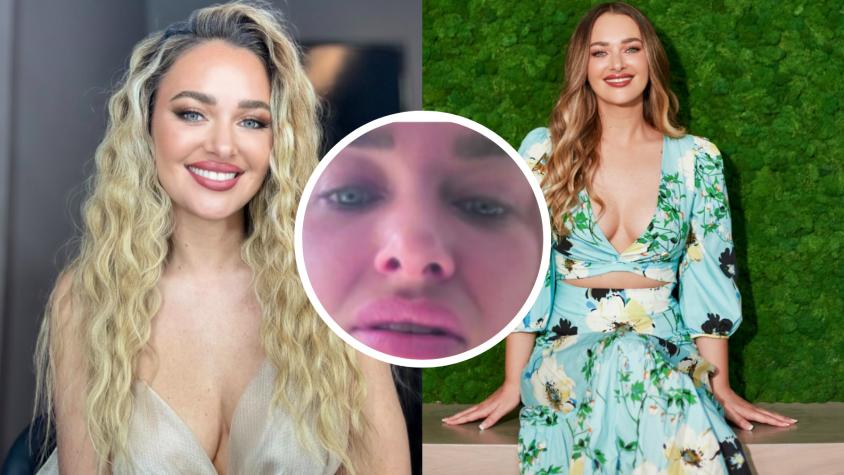 Daniela Nicolás revela video con importantes secuelas en su rostro tras grave accidente en Fiestas Patrias