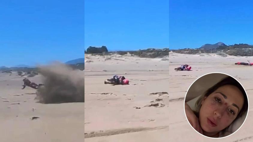 Salió eyectada: Video muestra el momento del grave accidente en moto que sufrió pareja de Nano Calderón