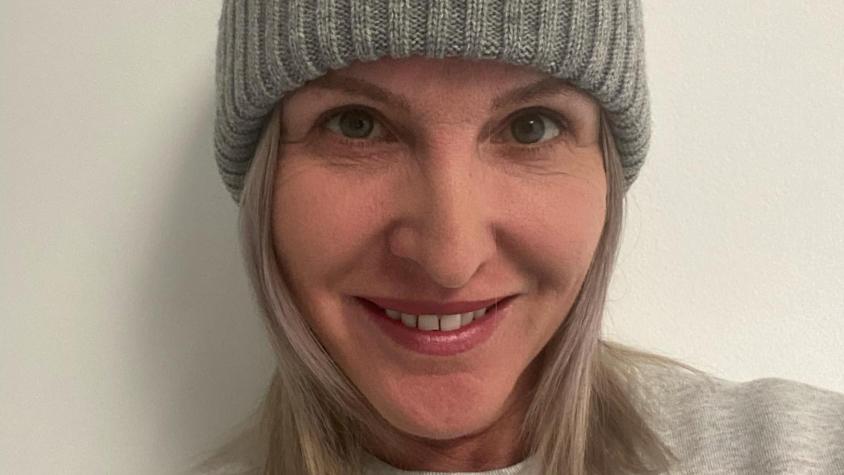 Mujer pagó millonario monto por un lifting y quedó con hoyos en la cara: cirujano tenía sólo una semana de formación 