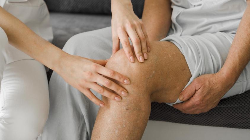 Afecta a 1 de cada 3 adultos: Expertos advierten sobre riesgo de várices no tratadas