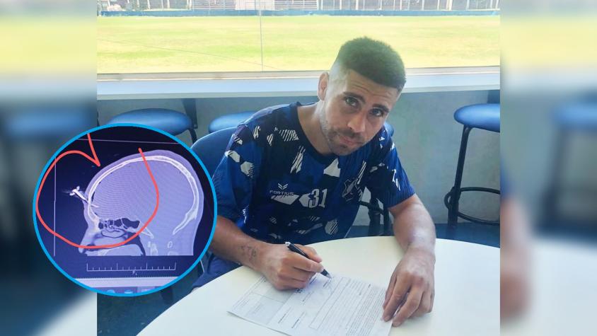 Brutal ataque en Argentina: Futbolista terminó con llave de auto enterrada en el cráneo mientras veía partido de su hija