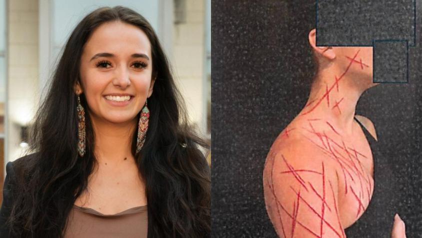 Exempleada republicana habría pagado para fingir agresión asegurando que se trataba de un ataque contra Trump