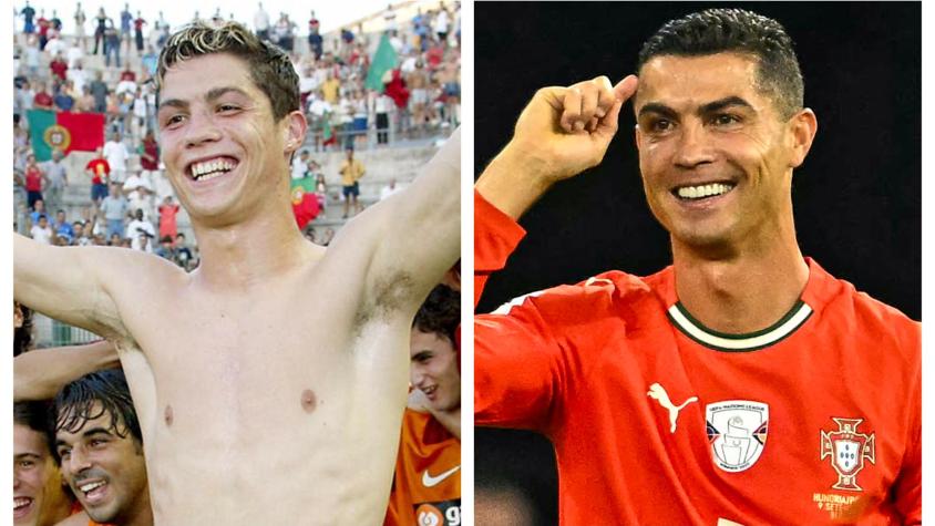 Cirujano plástico revela las 6 cirugías estéticas de Cristiano Ronaldo: costo supera los 200 millones de pesos