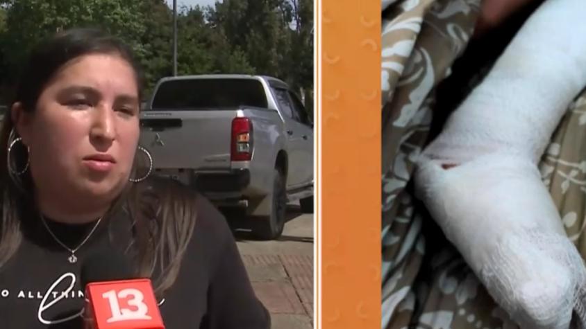 Solo pasa en Chile: menor que sufrió fractura de peroné fue inmovilizado con un cono de cartón en el SAR