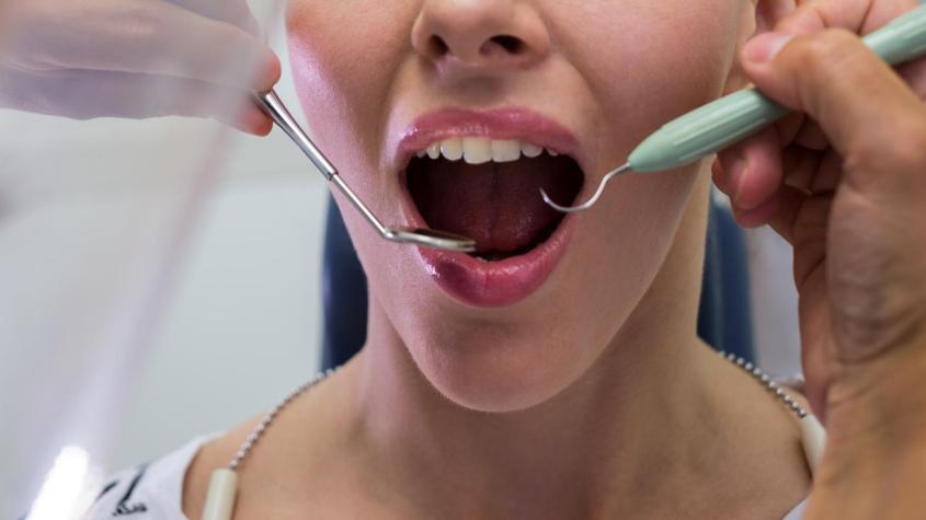 85% de los diagnósticos de cáncer oral son tardíos: A qué síntomas estar alerta y cuáles son los factores de riesgo