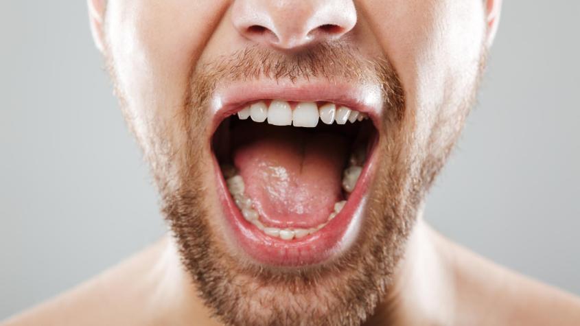 No basta solo con enjuague: Qué es la halitosis, por qué ocurre y cómo combatirla