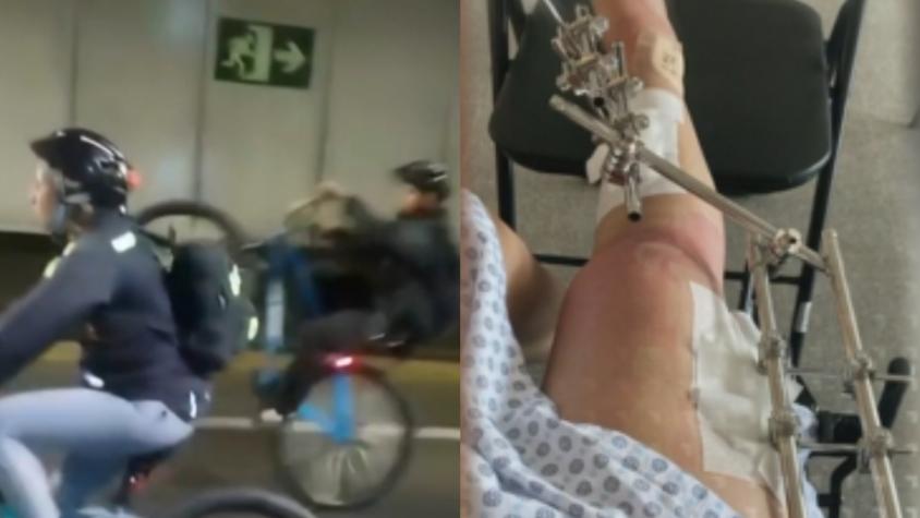 Ciclista quedó con múltiples fracturas tras ser atropellada por sujeto que realizaba maniobras: responsable se fugó