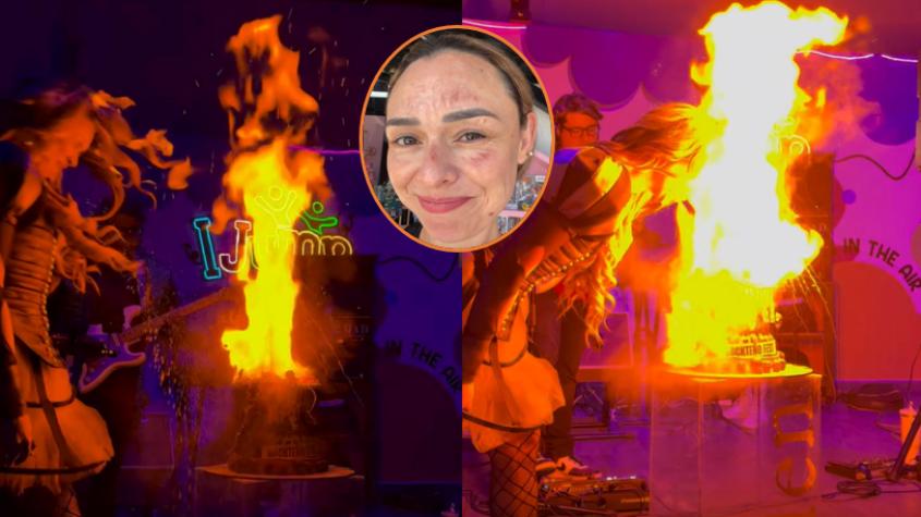 Influencer detalla cómo se quemó la cara en su cumpleaños tras seguir reto viral: "Me quedé sin pestañas, sin cejas"