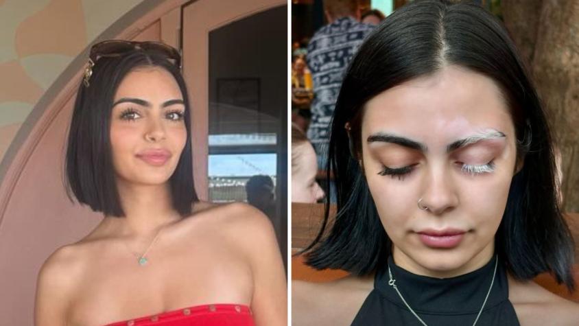 Joven se quemó con el sol, a las semanas le salieron costras y el diagnóstico le cambió la vida: se hizo viral