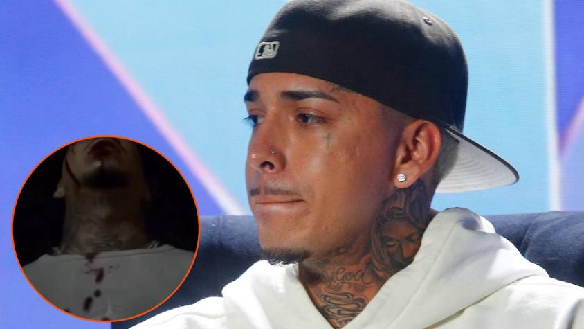 Young Cister preocupa a sus fans al publicar video desorientado y con su rostro aparentemente lleno de sangre