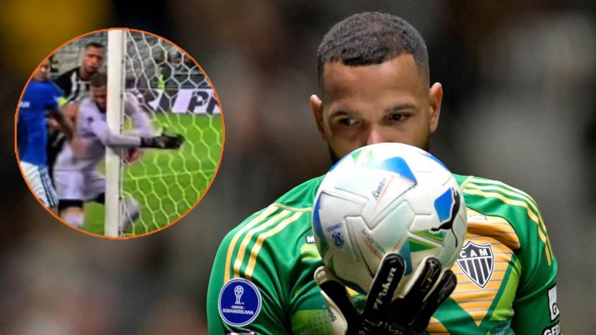 FOTO | Irreconocible: Así quedó el rostro de Everson tras la batalla campal en Brasil