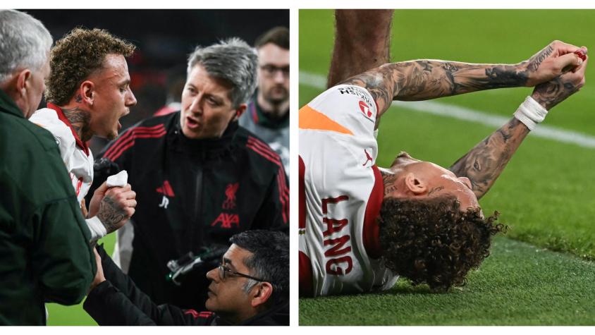 Jugador del Galatasaray sufre la semiamputación de su dedo tras chocar con un cartel en partido de la Champions