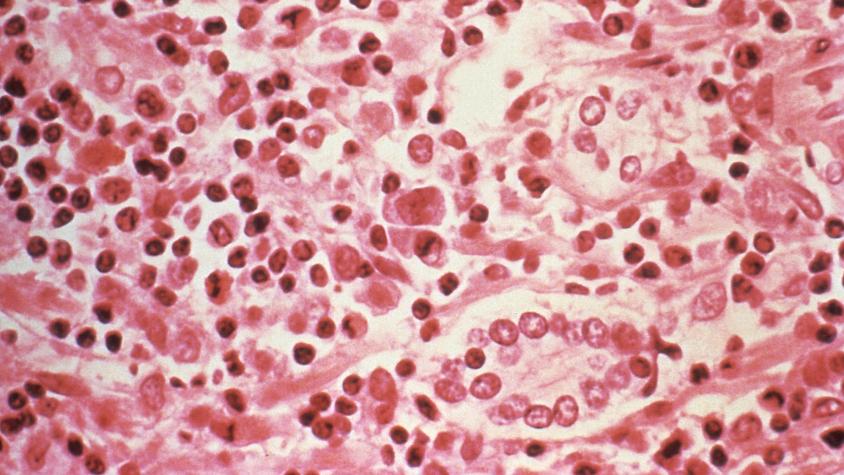 ¿Qué son los hantavirus y qué peligro representan?