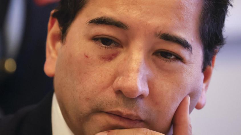 Detienen a dos personas por agresión contra diputado Javier Olivares