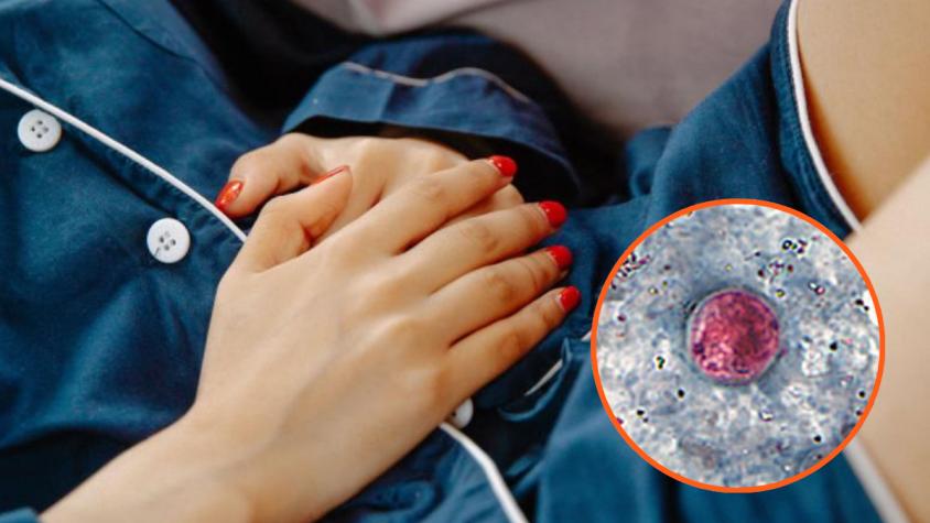 Qué es la ciclosporiasis, la infección provocada por un parásito que genera "diarrea explosiva" y que alarma a EE.UU.