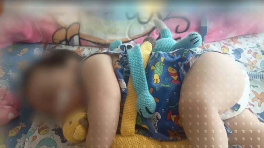 De la casa nueva a vivir entre hongos: Guagua fue hospitalizada por humedal en su casa