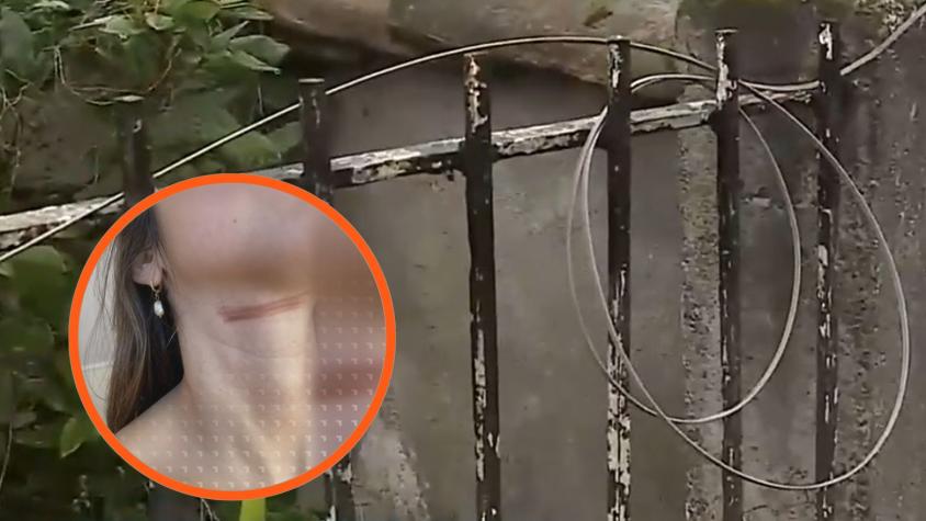Cable se atascó en cuello de joven que andaba en bicicleta: ¿Qué pasó con la Ley Chao Cables?