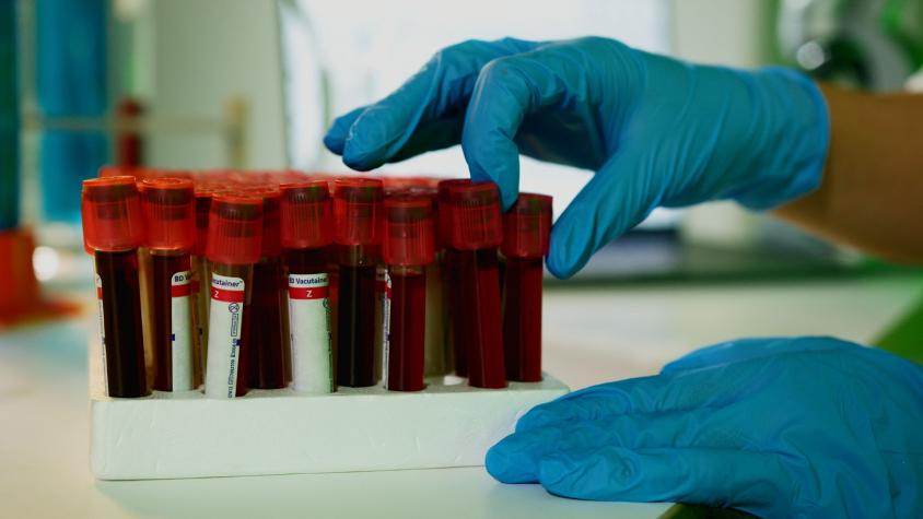 Investigadora de laboratorio ruso especializado en la peste muere por "desconocida" infección: 200 personas fueron aisladas