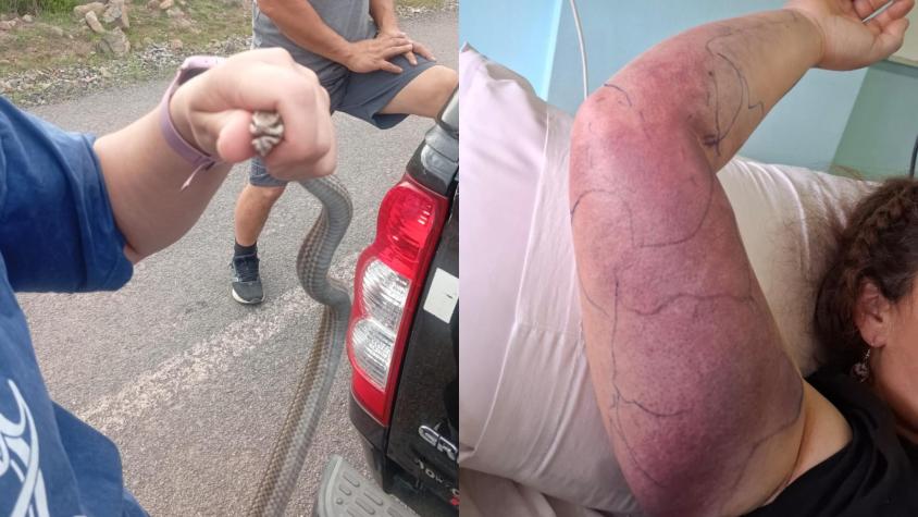 Mujer terminó hospitalizada tras tomar a culebra que la mordió en la carretera en Putaendo: experto explicó que son venenosas